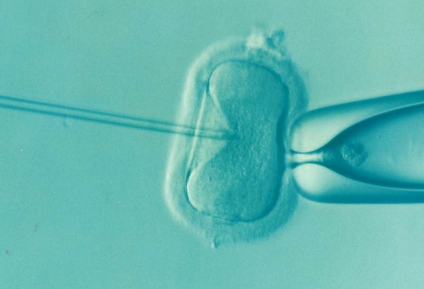 Качеството и на яйцеклетките, и на сперматозоидите на българите постепенно намалява