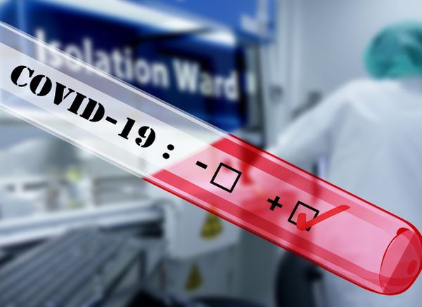 14 медици са с коронавирус за последното денонощие (Обновена)