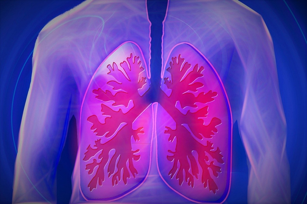 Ракът на белите дробове е водеща причина за смърт от онкологични заболявания в България