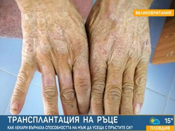 За уникална трансплантация на две ръце съобщиха преди дни медицински