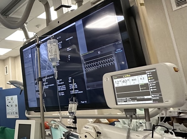 В УМБАЛ „Чирков“ имплантираха кардиовертер-дефибрилатори на шестима пациенти