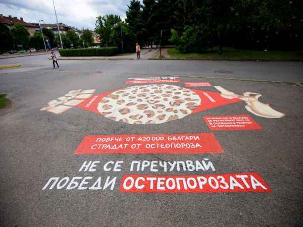 Повече от 420 000 българи страдат от остеопороза като 80