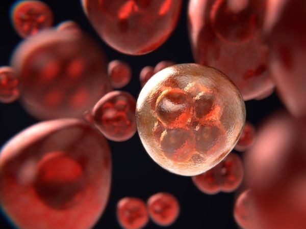 200 000 жени в света с рак на яйчниците са починали през 2020 г.