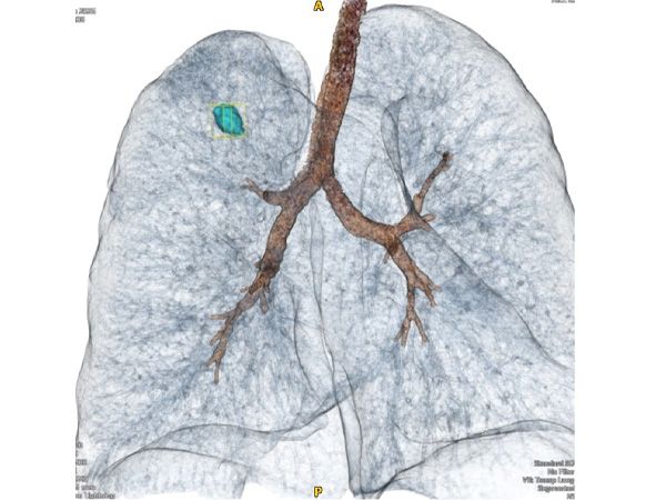 Отделението по хирургия и Отделението по образна диагностика на Университетската