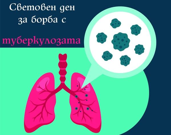 Днес отбелязваме Световния ден за борба с туберкулозата