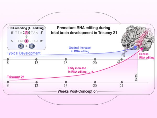 Учени от САЩ и България с откритие за различното развитие на мозъка при синдром на Даун