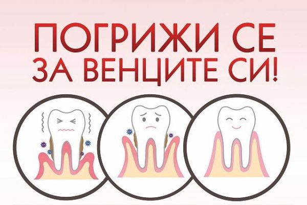 Кампанията „Погрижи се за венците си!“ организират студенти от МУ-Варна