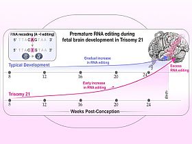 Учени от САЩ и България с откритие за различното развитие на мозъка при синдром на Даун
