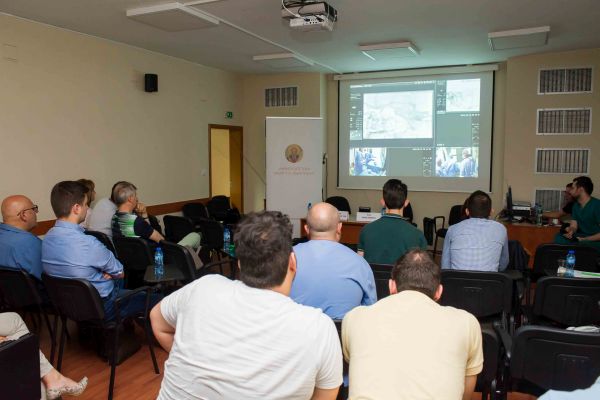  С успех е приключила интервенцията на първата гигантска мозъчна аневризма в УМБАЛ „Св. Иван Рилски“