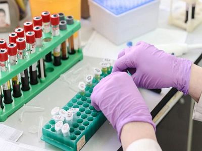Началникът на политическия кабинет на Борисов с положителна проба за COVID-19