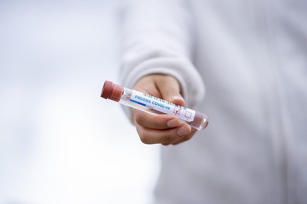 75 са вече лабораториите, правещи PCR-тестове