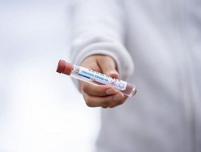 119 са лабораториите, чиито резултати от PCR-тестове се признават от МЗ