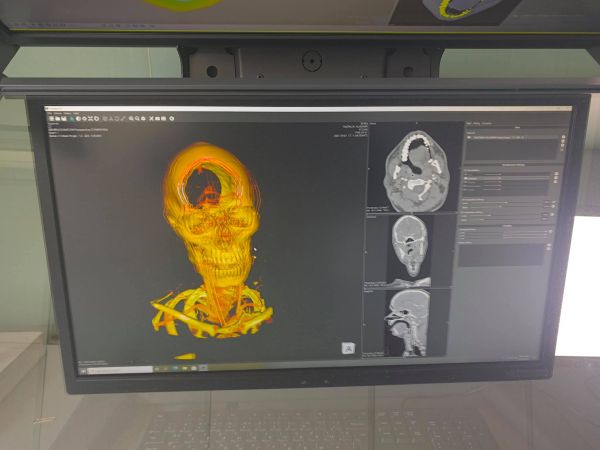 УМБАЛ „Св. Анна“ с нова 3D мониторна система