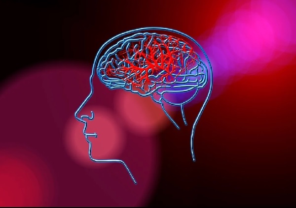 35 000 случая на мозъчен инсулт годишно се регистрират у нас