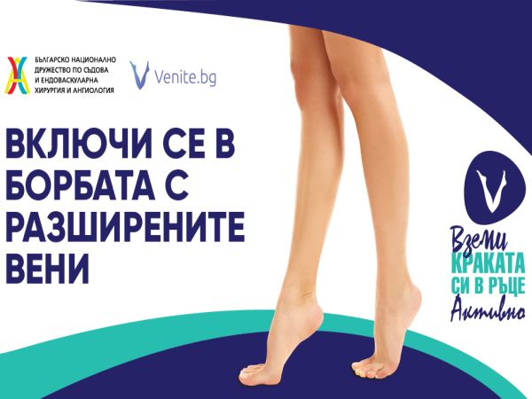 Хроничната венозна болест се 
