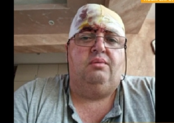 Д-р Димитров: Ако не беше катастрофата, пациентът в линейката можеше да бъде спасен