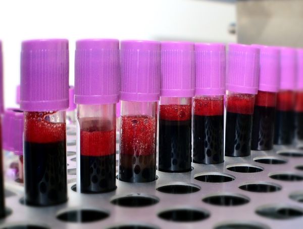 В Англия: 4800 души с хемофилия са били заразени с хепатит С за 20 г.