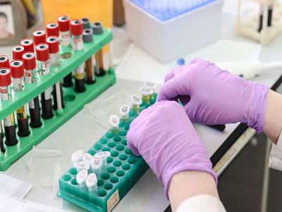 НАП започва проверки в лабораториите, които правят тестове за COVID