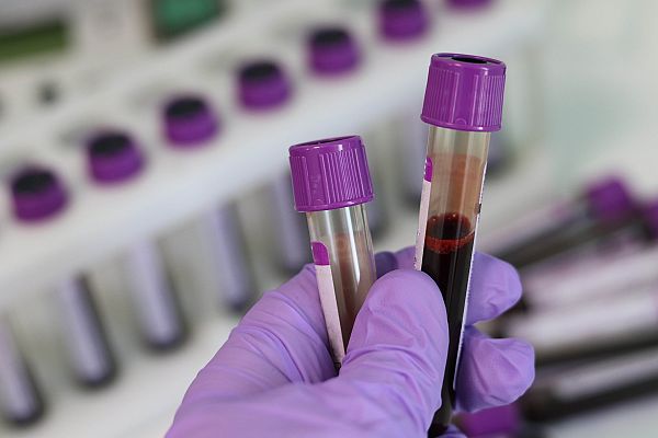 BioNTech включва и двувалентни COVID ваксини в програмата си за клинични изпитвания